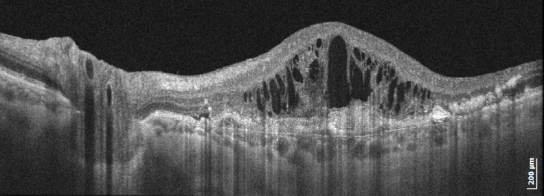 Esame Retina e Macula Referto OCT